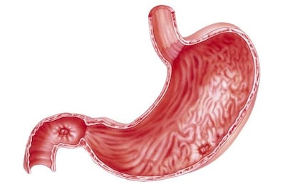 Which medications cause stomach ulcers?