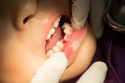 Phantom heads and fake teeth: how we tackled oral health in pharmacies