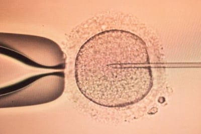 Male infertility causes and management